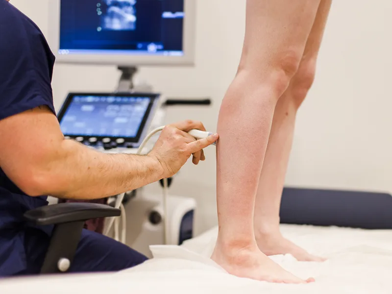 Дуплексное сканирование вен нижних конечностей