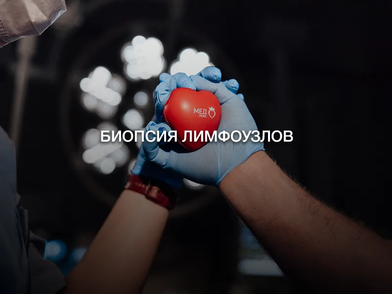 Биопсия лимфоузлов