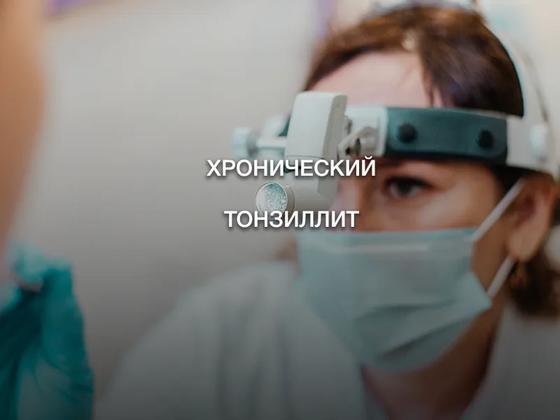 Хронический тонзиллит