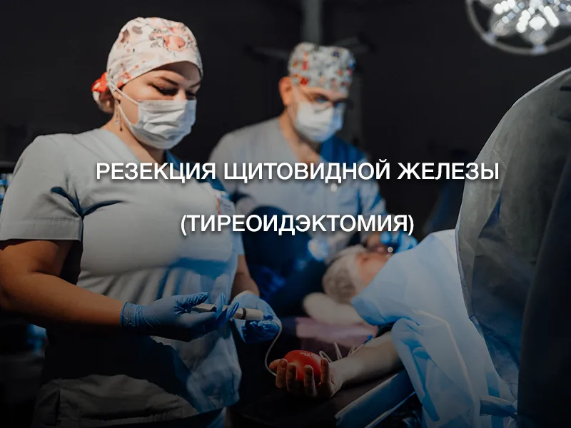 Резекция щитовидной железы (тиреоидэктомия)