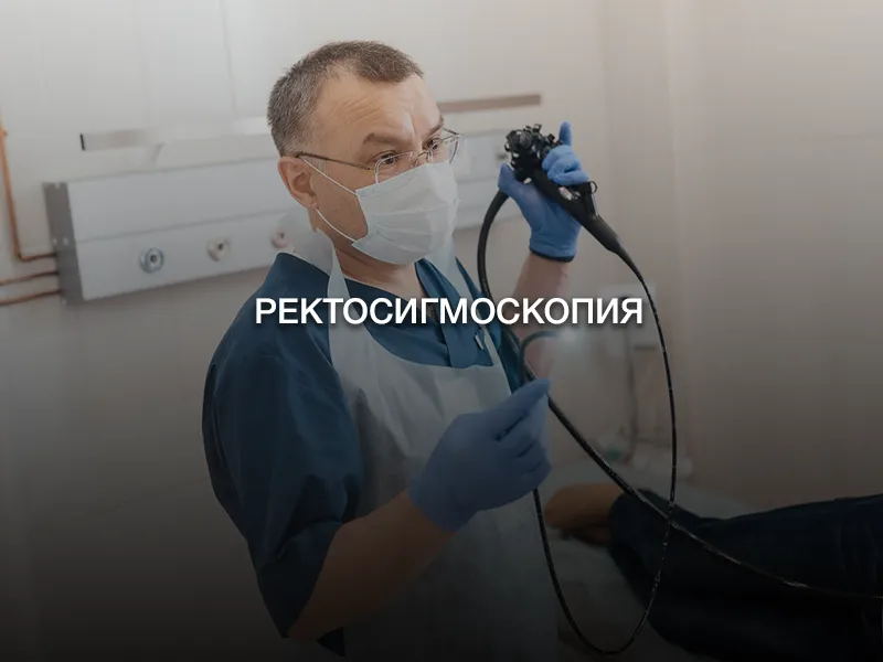 Ректосигмоскопия