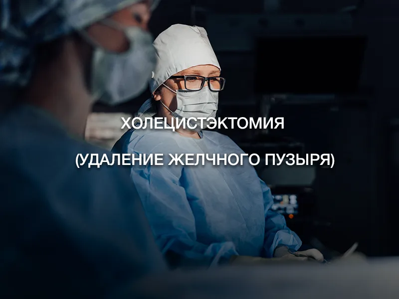 Холецистэктомия (удаление желчного пузыря)