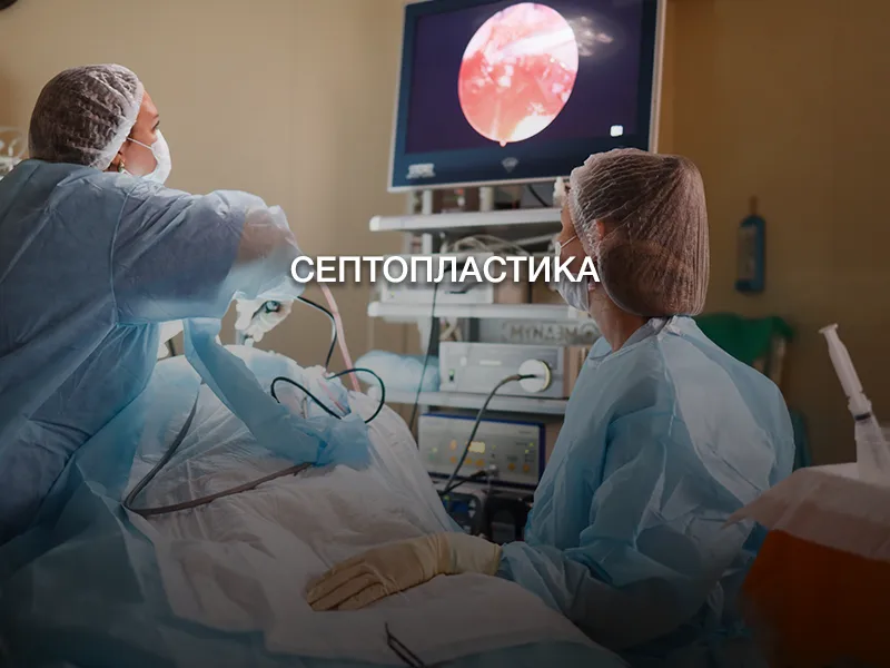 Септопластика