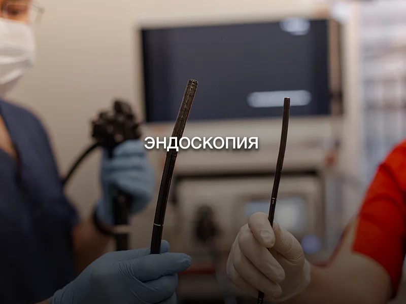 Эндоскопия