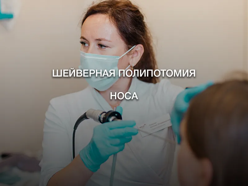 Шейверная полипотомия носа