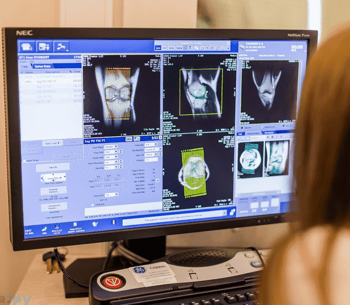 Рентгенография