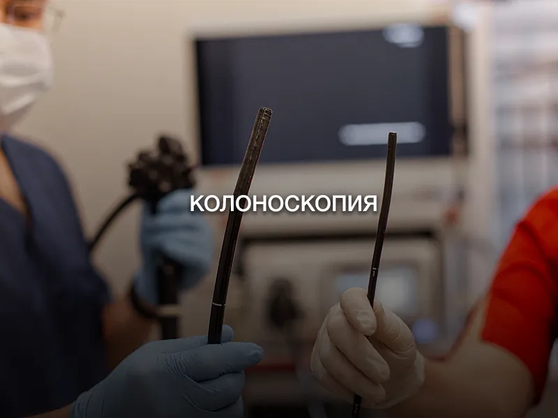 Колоноскопия