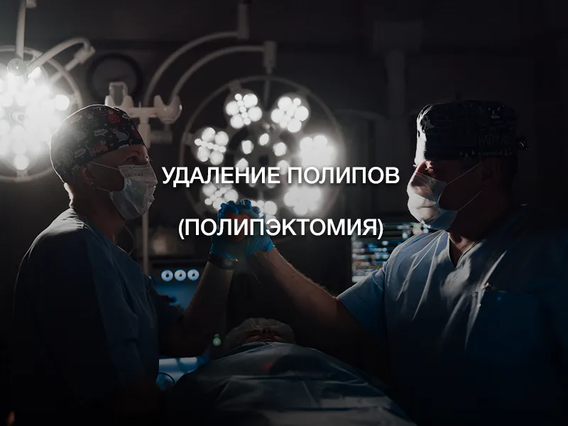 Удаление полипов (полипэктомия)