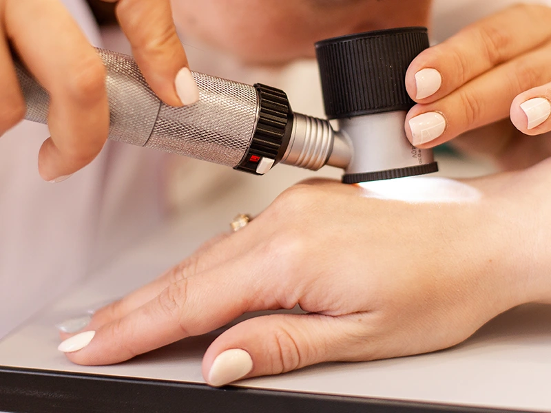 Дерматоонкология Дерматоонкология